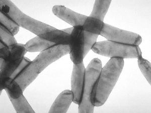 Legionella-pneumophila